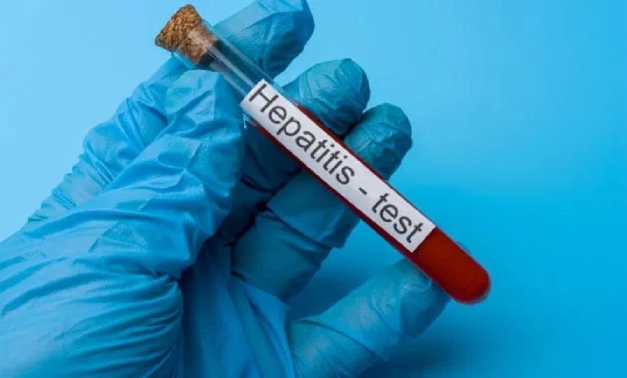 Hepatitis A Outbreak in Srinagar Infects 21, Surveillance Intensified