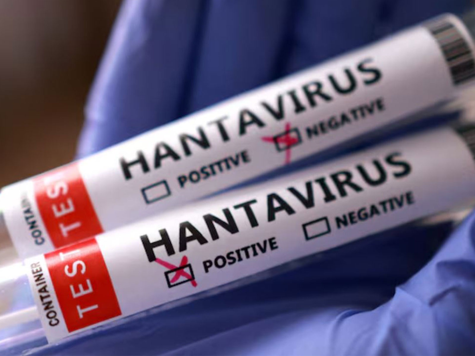 Shadow of Hantavirus: Expert warns of zoonotic threat, high fatality risk