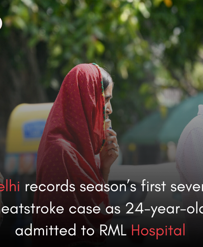 Delhi records season’s first severe heatstroke case as 24-year-old admitted to RML Hospital