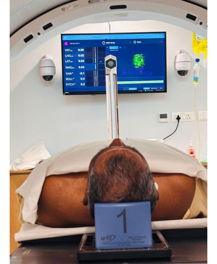 India achieves AI breakthrough in cancer care with mask-free, simulationless radiotherapy